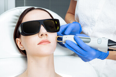 Woman having laser photo facial (IPL) treatment